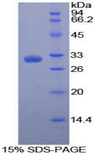 PVR / CD155 Protein - Recombinant Poliovirus Receptor By SDS-PAGE