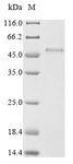 PVRIG Protein - (Tris-Glycine gel) Discontinuous SDS-PAGE (reduced) with 5% enrichment gel and 15% separation gel.