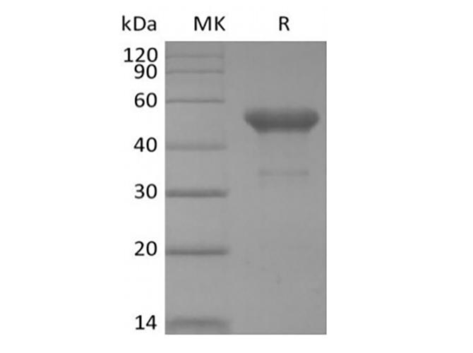 PVRIG Protein - Recombinant Human PVRIG (C-mFc)