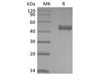 PVRIG Protein - 2.Immobilized Human PVRIG-mFc(Cat#PKSH034019) at 10µg/ml (100 µl/well) can bind Biotinylated Human Nectin-2-His-Avi(Cat#PKSH034032). The ED50 of Biotinylated Human Nectin-2-His-Avi(Cat#PKSH034032) is 0.42 ug/ml.Recombinant Human PVRIG (C-mFc)