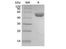 PVRL2 / CD112 Protein - Recombinant Human PVRL2/Nectin-2/CD112 (C-6His-Avi) Biotinylated