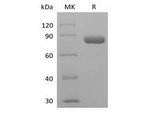 PVRL2 / CD112 Protein - Recombinant Human PVRL2/Nectin-2/CD112 (C-mIgG2a Fc)