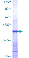 PVRL3 / Nectin-3 Protein - 12.5% SDS-PAGE Stained with Coomassie Blue.