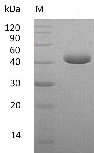 PVRL4 / Nectin 4 Protein - (Tris-Glycine gel) Discontinuous SDS-PAGE (reduced) with 5% enrichment gel and 15% separation gel.