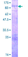 PVRL4 / Nectin 4 Protein - 12.5% SDS-PAGE of human PVRL4 stained with Coomassie Blue