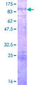 PVRL4 / Nectin 4 Protein - 12.5% SDS-PAGE of human PVRL4 stained with Coomassie Blue