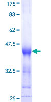 PVRL4 / Nectin 4 Protein - 12.5% SDS-PAGE Stained with Coomassie Blue.