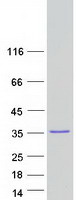 PXDC1 / C6orf145 Protein - Purified recombinant protein PXDC1 was analyzed by SDS-PAGE gel and Coomassie Blue Staining