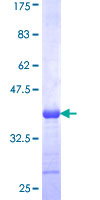 PXDN / MG50 Protein - 12.5% SDS-PAGE Stained with Coomassie Blue.