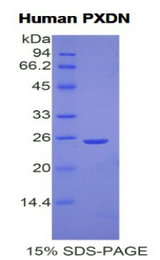 PXDN / MG50 Protein - Recombinant Peroxidasin Homolog By SDS-PAGE