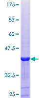 PXK Protein - 12.5% SDS-PAGE Stained with Coomassie Blue.