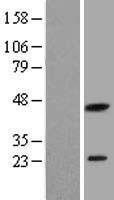 PXMP2 Protein - Western validation with an anti-DDK antibody * L: Control HEK293 lysate R: Over-expression lysate