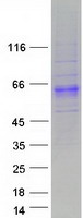 PXYLP1 / ACPL2 Protein - Purified recombinant protein PXYLP1 was analyzed by SDS-PAGE gel and Coomassie Blue Staining