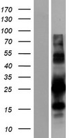 PYCR1 Protein - Western validation with an anti-DDK antibody * L: Control HEK293 lysate R: Over-expression lysate