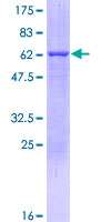 PYCR1 Protein - 12.5% SDS-PAGE of human PYCR1 stained with Coomassie Blue
