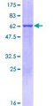 PYCR1 Protein - 12.5% SDS-PAGE of human PYCR1 stained with Coomassie Blue