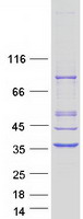 PYCR1 Protein - Purified recombinant protein PYCR1 was analyzed by SDS-PAGE gel and Coomassie Blue Staining