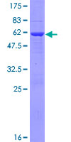 PYCRL Protein - 12.5% SDS-PAGE of human PYCRL stained with Coomassie Blue
