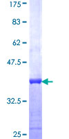 PYCRL Protein - 12.5% SDS-PAGE Stained with Coomassie Blue.