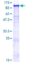 PYGL Protein - 12.5% SDS-PAGE of human PYGL stained with Coomassie Blue