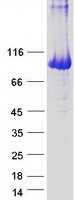 PYGL Protein - Purified recombinant protein PYGL was analyzed by SDS-PAGE gel and Coomassie Blue Staining