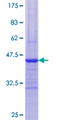 PYGM Protein - 12.5% SDS-PAGE Stained with Coomassie Blue.