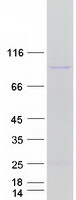 PYGM Protein - Purified recombinant protein PYGM was analyzed by SDS-PAGE gel and Coomassie Blue Staining