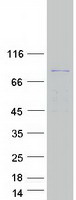PYGM Protein - Purified recombinant protein PYGM was analyzed by SDS-PAGE gel and Coomassie Blue Staining
