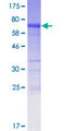 PYGO1 / Pygopus 1 Protein - 12.5% SDS-PAGE of human PYGO1 stained with Coomassie Blue