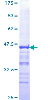 PYGO2 / Pygopus 2 Protein - 12.5% SDS-PAGE Stained with Coomassie Blue.