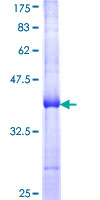 Pyrin / MEFV / MEF Protein - 12.5% SDS-PAGE Stained with Coomassie Blue.