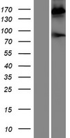 PZP Protein - Western validation with an anti-DDK antibody * L: Control HEK293 lysate R: Over-expression lysate