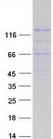 PZP Protein - Purified recombinant protein PZP was analyzed by SDS-PAGE gel and Coomassie Blue Staining