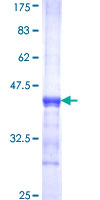 QCR2 / UQCRC2 Protein - 12.5% SDS-PAGE Stained with Coomassie Blue.