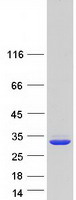 QDPR / DHPR Protein - Purified recombinant protein QDPR was analyzed by SDS-PAGE gel and Coomassie Blue Staining