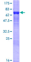 QIP1 / KPNA4 Protein - 12.5% SDS-PAGE of human KPNA4 stained with Coomassie Blue