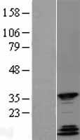 QKI Protein - Western validation with an anti-DDK antibody * L: Control HEK293 lysate R: Over-expression lysate