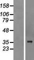 QKI Protein - Western validation with an anti-DDK antibody * L: Control HEK293 lysate R: Over-expression lysate