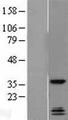 QKI Protein - Western validation with an anti-DDK antibody * L: Control HEK293 lysate R: Over-expression lysate
