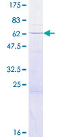 QKI Protein - 12.5% SDS-PAGE of human QKI stained with Coomassie Blue