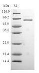 QKI Protein - (Tris-Glycine gel) Discontinuous SDS-PAGE (reduced) with 5% enrichment gel and 15% separation gel.