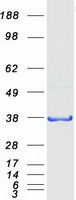 QKI Protein - Purified recombinant protein QKI was analyzed by SDS-PAGE gel and Coomassie Blue Staining