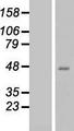 QPCT / QC Protein - Western validation with an anti-DDK antibody * L: Control HEK293 lysate R: Over-expression lysate