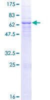 QPCT / QC Protein - 12.5% SDS-PAGE of human QPCT stained with Coomassie Blue