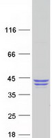 QPCT / QC Protein - Purified recombinant protein QPCT was analyzed by SDS-PAGE gel and Coomassie Blue Staining