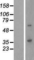 QPCTL Protein - Western validation with an anti-DDK antibody * L: Control HEK293 lysate R: Over-expression lysate