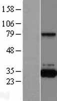 QPRT Protein - Western validation with an anti-DDK antibody * L: Control HEK293 lysate R: Over-expression lysate