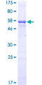 QPRT Protein - 12.5% SDS-PAGE of human QPRT stained with Coomassie Blue