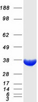 QPRT Protein - Purified recombinant protein QPRT was analyzed by SDS-PAGE gel and Coomassie Blue Staining