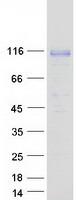 QRICH1 Protein - Purified recombinant protein QRICH1 was analyzed by SDS-PAGE gel and Coomassie Blue Staining